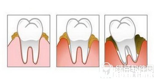 电动牙刷如何使用 电动牙刷的使用方法1